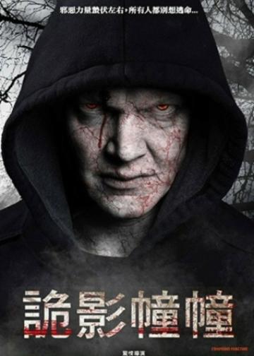 复合骨折